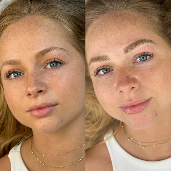Nano Brows before and after by Bravo Brows Co.